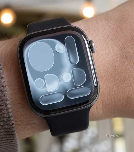 The Apple Watch Series 11 on someone's arm 